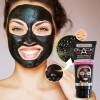 BLACK MASK 130 ML – MÁSCARA PRETA PONTOS NEGRO E ACNE